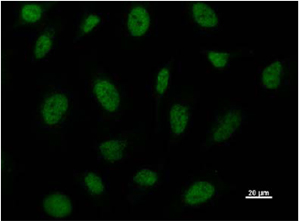 Immunoflourescent staining of Hela cells using ab50818 Anti-BRD3 Antibody (1/10 dilution) as primary and AlexaFluor®488 Goat Anti-mouse IgG( 1/200 dilution )