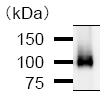 Immunoprecipitation of BRD3 from RIPA lysate of HeLa cells (500µg) using 5µg ab50818. Visualized by western blot using 1/50 ab50518 as primary and anti-mouse IgG secondary (1:2500).