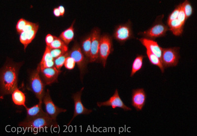 ICC/IF image of ab66443 stained HepG2 cells. The cells were 100% methanol fixed (5 min) and then incubated in 1%BSA / 10% normal goat serum / 0.3M glycine in 0.1% PBS-Tween for 1h to permeabilise the cells and block non-specific protein-protein interactions. The cells were then incubated with the antibody (ab66443, 5µg/ml) overnight at +4°C. The secondary antibody (green) was ab96899 Dylight® 488 goat anti-rabbit IgG (H+L) used at a 1/250 dilution for 1h. Alexa Fluor® 594 WGA was used to label plasma membranes (red) at a 1/200 dilution for 1h. DAPI was used to stain the cell nuclei (blue) at a concentration of 1.43µM.