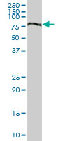Anti-Breast cancer suppressor candidate 1 antibody (ab89056) at 1 µg/ml + Human stomach lysate at 50 µg