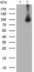All lanes : Anti-Breast cancer suppressor candidate 1 antibody [3A3] (ab128121) at 1/500 dilutionLane 1 : HEK293T cell lysate transfected with pCMV6-ENTRY controlLane 2 : HEK293T cell lysate transfected with pCMV6-ENTRY Breast cancer suppressor candidate 1 cDNALysates/proteins at 5 µg per lane.
