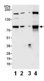 All lanes : Anti-BRF1 antibody (ab74221) at 0.04 µg/mlLane 1 : HeLa whole cell lysate at 50 µgLane 2 : HeLa whole cell lysate at 15 µgLane 3 : HeLa whole cell lysate at 5 µgLane 4 : 293T whole cell lysate at 50 µg