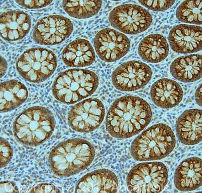 IHC image of ab52273 staining in human normal colon formalin fixed paraffin embedded tissue section, performed on a Leica BondTM system using the standard protocol F. The section was pre-treated using heat mediated antigen retrieval with sodium citrate buffer (pH6, epitope retrieval solution 1) for 20 mins. The section was then incubated with ab52273, 5µg/ml, for 15 mins at room temperature and detected using an HRP conjugated compact polymer system. DAB was used as the chromogen. The section was then counterstained with haematoxylin and mounted with DPX.For other IHC staining systems (automated and non-automated) customers should optimize variable parameters such as antigen retrieval conditions, primary antibody concentration and antibody incubation times.