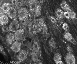 Immuofluorescent staining for BRN3A in the rat dorsal root ganglion using Rabbit polyclonal to BRN3A (ab30880; images taken with X20 objective). ab30880 was used at 1/1000 (0.54µg/ml) incubated overnight at room temperature. Secondary antibody used was anti-rabbit Alexa Fluor 488 at 1/1000 incubated for 2 hours at room temperature. Rat tissue was perfusion fixed with 4% PFA followed by overnight post-fixation in the same fixative, cryoprotected in 20% sucrose and frozen in OCT. 30µm coronal sections were cut on a cyrostat and immunohistochemistry performed by the 'free floating' technique.