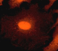Immunofluorescent staining of HeLa cells using 1/100 ab81213.
