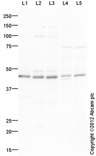 All lanes : Anti-BSCL2 antibody (ab106793) at 1 µg/mlLane 1 : Brain (Human) Tissue Lysate - adult normal tissue (ab29466)Lane 2 : Brain (Mouse) Tissue LysateLane 3 : Brain (Rat) Tissue LysateLane 4 : Testis (Mouse) Tissue LysateLane 5 : Testis (Rat) Tissue LysateLysates/proteins at 10 µg per lane.SecondaryGoat Anti-Rabbit IgG H&L (HRP) preadsorbed (ab97080) at 1/5000 dilutiondeveloped using the ECL techniquePerformed under reducing conditions.