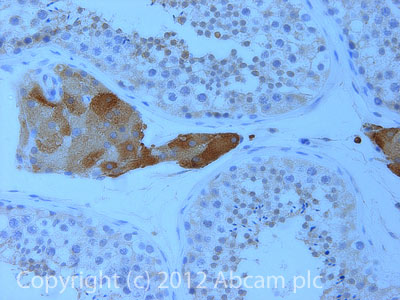 IHC image of BSCL2 staining in Human normal testis formalin fixed paraffin embedded tissue section, performed on a Leica BondTM system using the standard protocol F. The section was pre-treated using heat mediated antigen retrieval with EDTA (pH9, epitope retrieval solution 2) for 20 mins. The section was then incubated with ab106793, 5µg/ml, for 15 mins at room temperature and detected using an HRP conjugated compact polymer system. DAB was used as the chromogen. The section was then counterstained with haematoxylin and mounted with DPX.For other IHC staining systems (automated and non-automated) customers should optimize variable parameters such as antigen retrieval conditions, primary antibody concentration and antibody incubation times.