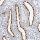 ab122170 at 1/300 dilution staining BSDC1 in Paraffin-embedded Human corpus, uterine tissue by Immunohistochemistry.