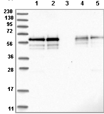 All lanes : Anti-BSDC1 antibody (ab122170) at 1/250 dilutionLane 1 : RT 4 lysateLane 2 : U 251 MG lysateLane 3 : Human plasma lysateLane 4 : Human liver lysateLane 5 : Human tonsil lysatedeveloped using the ECL technique