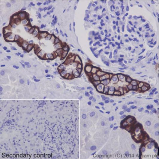 Immunohistochemical analysis of paraffin-embedded Human kidney tissue labeling BSND with ab196017 at 1/2000. Secondary antibody: Goat Anti-Rabbit IgG H&L (HRP) (ab97051) at 1/500.Inset image: negative control obtained using PBS instead of ab196017 and secondary antibody only.Note: Membrane and cytoplasm staining on human kidney tissue was observed.