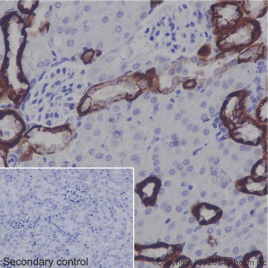 Immunohistochemical analysis of paraffin-embedded Mouse kidney tissue labeling BSND with ab196017 at 1/2000. Secondary antibody: Goat Anti-Rabbit IgG H&L (HRP) (ab97051) at 1/500.Inset image: negative control obtained using PBS instead of ab196017 and secondary antibody only.Note: Membrane and cytoplasm staining on mouse kidney tissue was observed.