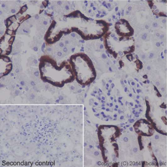 Immunohistochemical analysis of paraffin-embedded Rat kidney tissue labeling BSND with ab196017 at 1/2000. Secondary antibody: Goat Anti-Rabbit IgG H&L (HRP) (ab97051) at 1/500.Inset image: negative control obtained using PBS instead of ab196017 and secondary antibody only.Note: Membrane and cytoplasm staining on rat kidney tissue was observed.