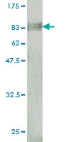 Western blot against tagged recombinant protein immunogen using ab54886 BTD antibody at 1ug/ml.