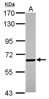Anti-BTD antibody (ab126140) at 1/1000 dilution + Jurkat lysate at 30 µg