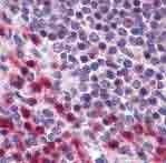 ab77989, at 10µg/ml, staining BTF in human spleen tissue by immunohistochemistry using formalin-fixed, paraffin-embedded tissue.