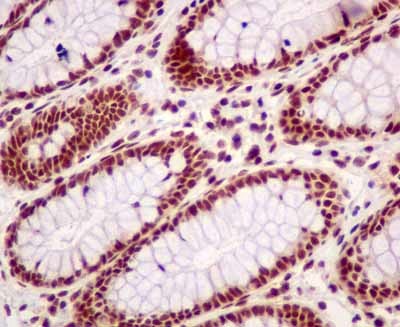 Immunohistochemical analysis of paraffin-embedded Human colon tissue labeling BTF with ab181240 at 1/100 dilution followed by prediluted HRP Polymer for Rabbit IgG. Counter stained with hematoxylin.