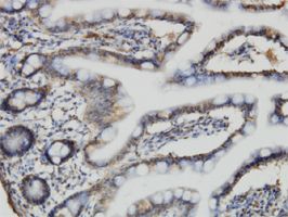 ACBD3 antibody (ab57568) used in immunohistochemistry at 3ug/ml on formalin fixed and paraffin embedded human small Intestine.