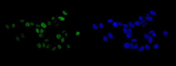 Immunofluorescent analysis of 4% paraformaldehyde-fixed MCF-7 cells labeling BTF with ab181240 at 1/500 dilution followed by Goat anti rabbit IgG (Alexa Fluor®488) secondary antibody at 1/200 dilution. Counter stained with Dapi (blue).
