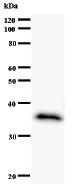 Anti-Bub1 antibody [2096C1a] (ab51269)