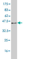 Western blot against tagged recombinant protein immunogen using ab56426 BUD31 antibody at 1ug/ml.