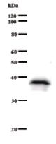 Anti-BXDC2 antibody [2092C1a] (ab51271)