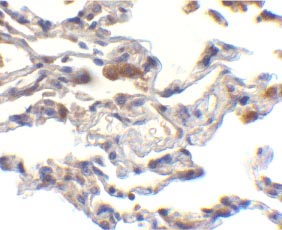ab25939 at 10µg/ml staining cIAP1 in human lung cells by IHC 