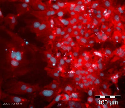 Immunostaining of mouse embryonic stem cells using c-Kit (Biotin) ab25022. The antibody bound to the cells was detected by treatment with Cy3-conjugated streptavidin (25 µg/ml). The image shows a fragment of an adherent colony of mouse embryonic stem cell-derived hepatocyte precursor cells stained with the ab25022 antibody and subsequently treated with Cy3-conjugated streptavidin. Cell nuclei were stained with DAPI. The Cy3 fluorescence pattern suggests the predominant expression of c-Kit in actively proliferating cells in the middle of colonies. Please see abreview for ICC/IF protocol details.See Abreview