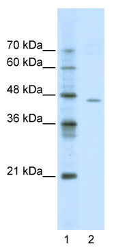 Lane 1 :  MARKERLane 2 :  Anti-ACCN4 antibody (ab49023) at 0.5 µg/mlLane 1 : As aboveLane 2 : Jurkat cell lysate at 10 µg with 5% skimmed milk in PBS.SecondaryLane 2 : HRP conjugated anti-Rabbit IgG at 1/50000 dilution