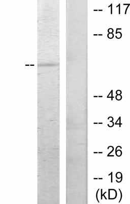 All lanes : Anti-c-Rel antibody (ab31413) at 1/500 dilutionLane 1 : MDA-MB-435 cells.Lane 2 : MDA-MB-435 cells. Using same antibody pre-incubated with synthesized peptide.