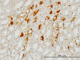 C1 Inactivator antibody (ab54898) used in immunohistochemistry at 1ug/ml on formalin fixed and paraffin embedded human kidney.