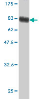 Western blot against tagged recombinant protein immunogen using ab54898 C1 Inactivator antibody at 1ug/ml.