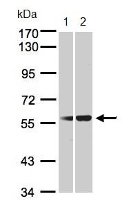 All lanes : Anti-C1 Inactivator antibody (ab97348) at 1/1000 dilutionLane 1 : 293T whole cell lysateLane 2 : HeLa S3 whole cell lysateLysates/proteins at 30 µg per lane.