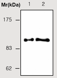 All lanes : Anti-C1 Inactivator antibody [4G12] (ab36992)Lane 1 : C1 inhibitor isolated from Human plasmaLane 2 : Human plasmaLysates/proteins at 50 µg per lane.Secondaryanti-mouse IgG -HRP