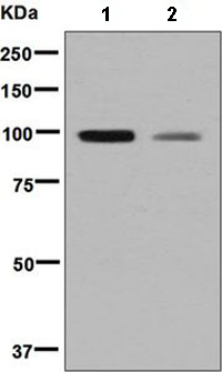 All lanes : Anti-C1 Inactivator antibody [EPR8015] (ab134918) at 1/1000 dilutionLane 1 : Human serum lysateLane 2 : Human plasma lysateLysates/proteins at 10 µg per lane.SecondaryGoat-anti-rabbit HRP at 1/2000 dilution