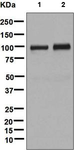 All lanes : Anti-C1 Inactivator antibody [EPR8016] (ab134915) at 1/1000 dilutionLane 1 : Human plasma lysateLane 2 : Human serum lysateLysates/proteins at 10 µg per lane.SecondaryHRP-conjugated goat anti-rabbit IgG at 1/2000 dilution