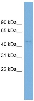 Anti-C10orf30 antibody (ab102622) at 1 µg/ml + HT1080 cell lysate at 10 µg