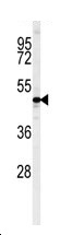 Anti-C10orf46 antibody (ab103403) at 1/100 dilution + A375 cell line lysates at 35 µg