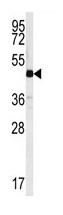 Anti-C10orf46 antibody (ab103403) at 1/100 dilution + Mouse cerebellum tissue lysates at 35 µg