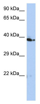 Anti-C10orf46 antibody (ab90162) at 1 µg/ml + HT1080 cell lysate at 10 µgSecondaryHRP conjugated anti-Rabbit IgG at 1/50000 dilution