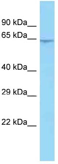 Anti-C10orf68 antibody (ab125359) at 1 µg/ml + 293T cell lysate at 10 µg