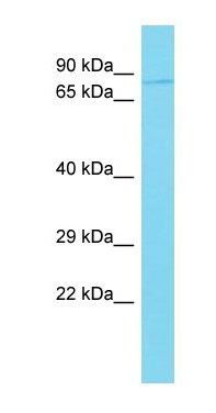 Anti-C10orf90 antibody - C-terminal (ab150710) at 1 µg/ml + 721_B Whole Cell lysates at 10 µg