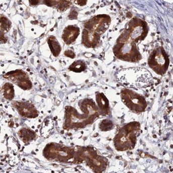 ab126479, at 1/200 dilution, staining C11orf10 in paraffin-embedded Human breast tissue by Immunohistochemistry.