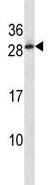 Anti-C11orf20 antibody (ab123745) at 1/100 dilution + WiDr cell line lysates at 35 µg