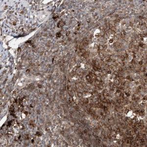 ab122349, at a 1/450 dilution, staining C11orf51 in paraffin-embedded Human appendix tissue by immunohistochemistry.