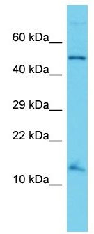 Anti-C11orf51 antibody - N-terminal (ab167460) at 1 µg/ml + HT1080 cell lysate at 10 µg