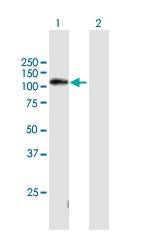 All lanes : Anti-C11orf82 antibody (ab169220) at 1 µg/mlLane 1 : C11orf82 transfected 293T lysateLane 2 : Non-transfected 293T lysateLysates/proteins at 15 µl per lane.SecondaryGoat Anti-Mouse IgG at 1/2500 dilution