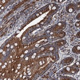 ab122483 at 1/50 dilution staining C11orf82 in paraffin-embedded Human duodenum tissue by Immunohistochemistry.