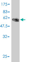 Western blot against tagged recombinant protein immunogen using ab57104 C12orf24 antibody at 1ug/ml.