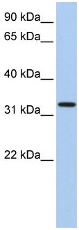 Anti-C12orf24 antibody (ab81771) at 1 µg/ml + Fetal heart lysate at 10 µgSecondaryHRP conjugated anti-Rabbit IgG at 1/50000 dilution
