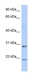 Anti-C12orf53 antibody (ab90067) at 1 µg/ml (in 5% skim milk / PBS buffer) + Human fetal spleen lysate at 10 µgSecondaryHRP conjugated anti-Rabbit IgG at 1/50000 dilution